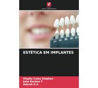 ESTÉTICA EM IMPLANTES