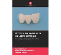 Estética Em Prótese de Implante Anterior: Uma revisão exaustiva dos parâmetros estéticos