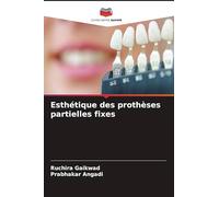 Esthétique des prothèses partielles fixes