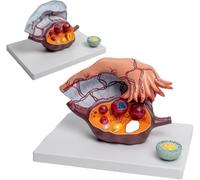 Estructura femenina de útero y ovario, modelo agrandado 5X, medicina ginecológica, modelo de anatomía, 3 piezas extraíbles de anatomía