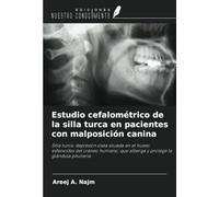 Estudio cefalométrico de la silla turca en pacientes con malposición canina