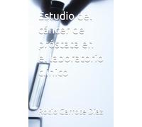 Estudio del cáncer de próstata en el laboratorio clínico