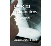 Estudios radiológicos de cáncer