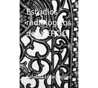 Estudios radiológicos de la EPOC