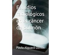 Estudios radiológicos en el cáncer de pulmón