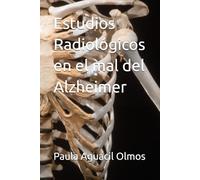 Estudios Radiológicos en el mal del Alzheimer