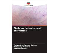 Étude sur le traitement des varices
