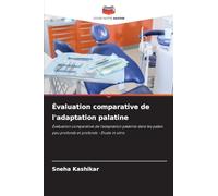 Évaluation comparative de l'adaptation palatine