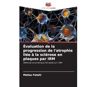 Évaluation de la progression de l'atrophie liée à la sclérose en plaques par IRM: Méthode volumétrique FSL basée sur l'IRM