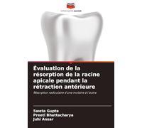 Évaluation de la résorption de la racine apicale pendant la rétraction antérieure: Résorption radiculaire d'une molaire à l'autre