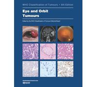 Eye and Orbit Tumours: Who Classification of Tumours