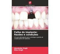 Falha do implante: Razões e condições: Um guia abrangente para a etiologia e gestão de complicações de implantes