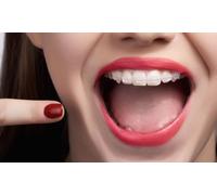 Férula de descarga rígida Michigan con limpieza dental