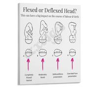 Fetal Station and Position Guide Poster for Labor and Delivery Nurses Educational Chart for Delivery Room(Unframed,16x24inch(40x60cm))