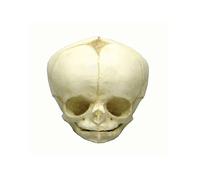 Fetus cráneo Anatomía Modelo, modelo cráneo, Fetus, varios. Desarrollo de semanas