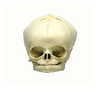 Fetus cráneo Anatomía Modelo, modelo cráneo, Fetus, varios. Desarrollo de semanas