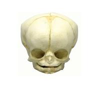 Fetus cráneo Anatomía Modelo, modelo cráneo, Fetus, varios. Desarrollo de semanas