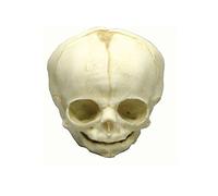Fetus cráneo Anatomía Modelo, modelo cráneo, Fetus, varios. Desarrollo de semanas