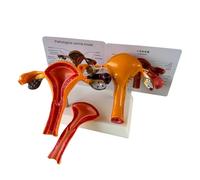 FHUILIJH A,Life Size, Modelo de Patología Anatómica del Útero Modelo de Anatomía Reproductiva y Ovárica Cambios Patológicos Útero Modelo Científico para Enseñanza