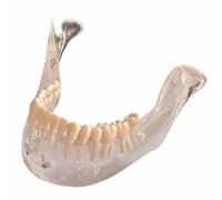 FHUILIJH Modelo de Mandíbula y Mandíbula Inferior con Dientes - Modelo Dental Mandibular - para Enseñanza e Investigaciones Médicas,Clear,9cm
