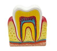 FHUILIJH Modelo de visualización de sección Transversal de Diente Seis Veces más Grande - Modelo de enseñanza Oral del nervio Dental - para visualización de Estudio de enseñanza,Flesh,8cm