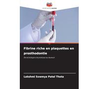 Fibrine riche en plaquettes en prosthodontie: De la biologie à la pratique au fauteuil