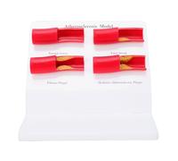 FILFEEL Modelo de Aterosclerosis Humana, Estructuras Anatómicas de Texturas Claras con Placa Extraíble para Aulas, Laboratorios, Clínicas