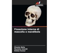 Fissazione interna di mascella e mandibola