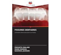 Fissures Dentaires: La frontière ténue entre la force et l'échec