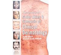 Fitzpatrick's Color Atlas and Synopsis of Clinical Dermatology: Sixth Edition