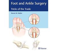 Foot and Ankle Surgery: Tricks of the Trade