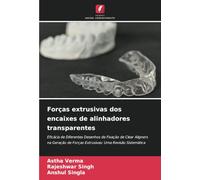Forças extrusivas dos encaixes de alinhadores transparentes: Eficácia de Diferentes Desenhos de Fixação de Clear Aligners na Geração de Forças Extrusivas: Uma Revisão Sistemática
