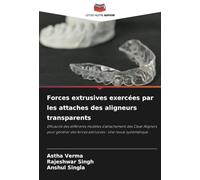 Forces extrusives exercées par les attaches des aligneurs transparents: Efficacité des différents modèles d'attachement des Clear Aligners pour générer des forces extrusives : Une revue systématique