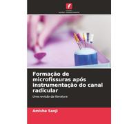 Formação de microfissuras após instrumentação do canal radicular: Uma revisão da literatura