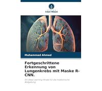 Fortgeschrittene Erkennung von Lungenkrebs mit Maske R-CNN.: Ein Deep Learning-Ansatz für die medizinische Bildgebung