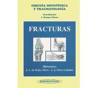 Fracturas. Cirugía Ortopédica y Traumatología