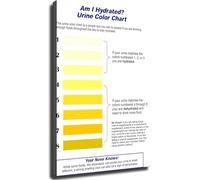 Functional Health Decor Hydration Indicator Chart Informative Poster for Bathroom Gym Wellness Area Home Office(Framed,16x24inch(40x60cm))