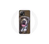 Funda - Xiaomi - Mi 11 Lite - Flexible - Perro Pitbull - Blanco y gris