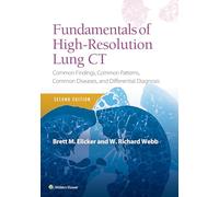 Fundamentals of High-Resolution Lung CT: Common Findings, Common Patterns, Common Diseases and Differential Diagnosis