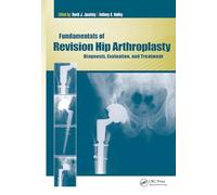 Fundamentals of Revision Hip Arthroplasty: Diagnosis, Evaluation, and Treatment