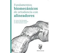 Fundamentos biomecánicos de ortodoncia con alineadores