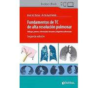 FUNDAMENTOS DE TC DE ALTA RESOLUCION PULMONAR HALLAZGOS