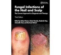 Fungal Infections of the Nail and Scalp: The Current Approach to Diagnosis and Therapy
