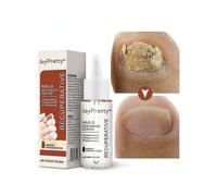 Fungal Nail Care Essence Foot Repair Essence Toe Whitening Treatment, Anti-infective Gel, 20 Ml