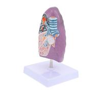 FUNOMOCYA Patológico de Pulmón para Enseñanza Médica Anatomía Respiratoria para Escuelas y Universidades