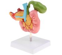 FytStycale 1: 1 Páncreas Humano Duodeno Vesícula Biliar Modelo Patológico