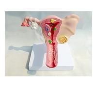 GDHKDDFL Modelos didácticos de biología, Útero y ovarios Órgano genital Femenino Modelo anatómico ginecológico de útero
