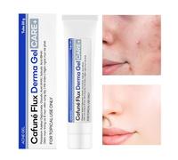 Gel Para El Rostro Contra Imperfecciones | Solución de Eliminación No Grasa y Ligera - Gel De Cuidado Para El Acné | Para Chica Familia Amigos Colegas Uso Diario Viaje Noche Mañana