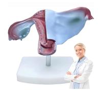 Genéric Modelo De Útero Y Ovario Humano,Modelo Anatómico De Los Órganos Reproductores Femeninos,para Estudio Y Enseñanza En El Aula,16X8X5CM
