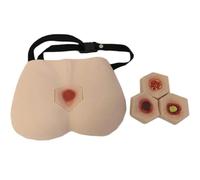 Genérico 4 etapas de las úlceras por presión - Modelo de cuidado de úlceras por decúbito - Simulador de úlceras por presión Modelo de enfermería Modelo de cuidado de heridas por decúbito